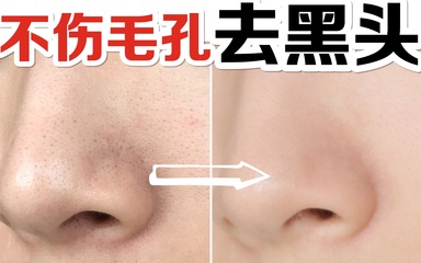 在家打造光潔肌 零損傷去黑頭去角質(zhì)全攻略